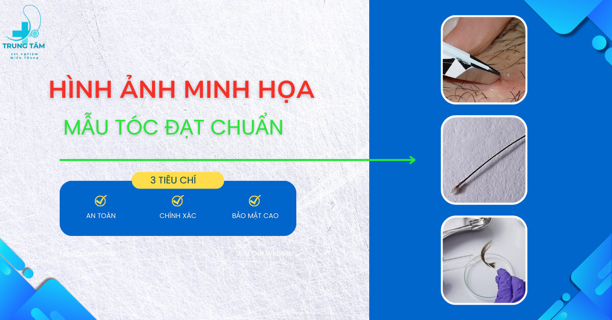 Hình ảnh minh họa cách nhổ tóc có nang để lấy mẫu